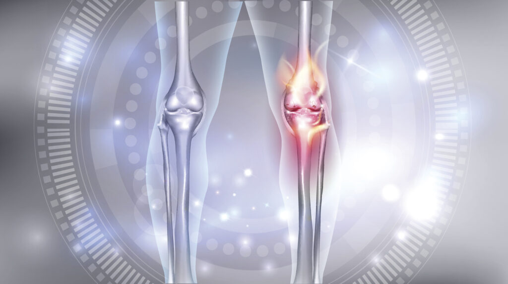 プロテオグリカンとは？ひざの違和感対策で注目される理由と、いま分かっているエビデンス